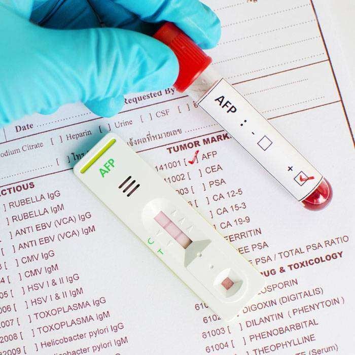 GAlfa Fetoprotein (afp) Nedir?