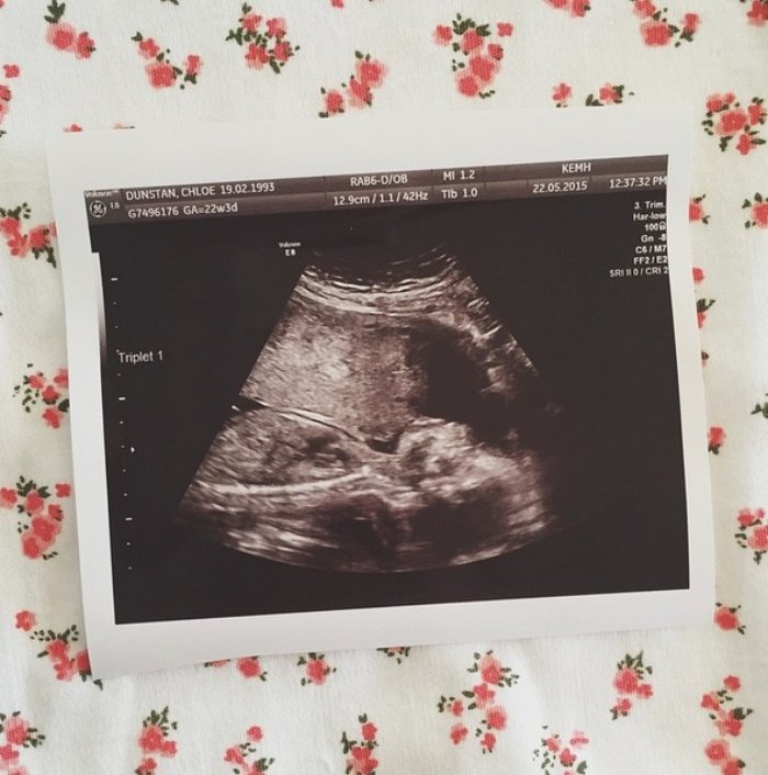 ucuzlerden-ikisi-erkek-biri-kız-5