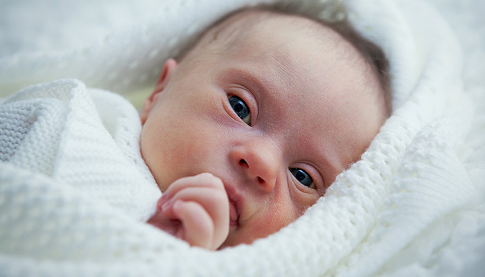 down-sendromu-belirtileri