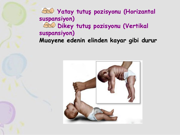 hipotonik bebek görüntüsü