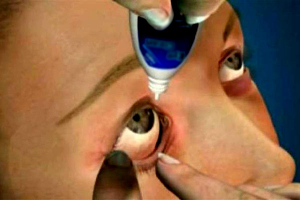 gebelikte göz tansiyonu damlası