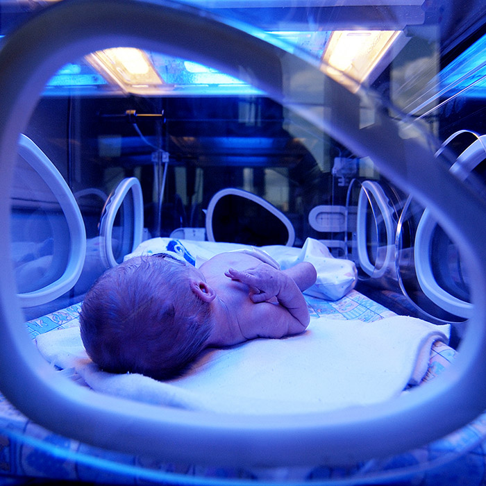 GPrematüre Bebek Nedir?