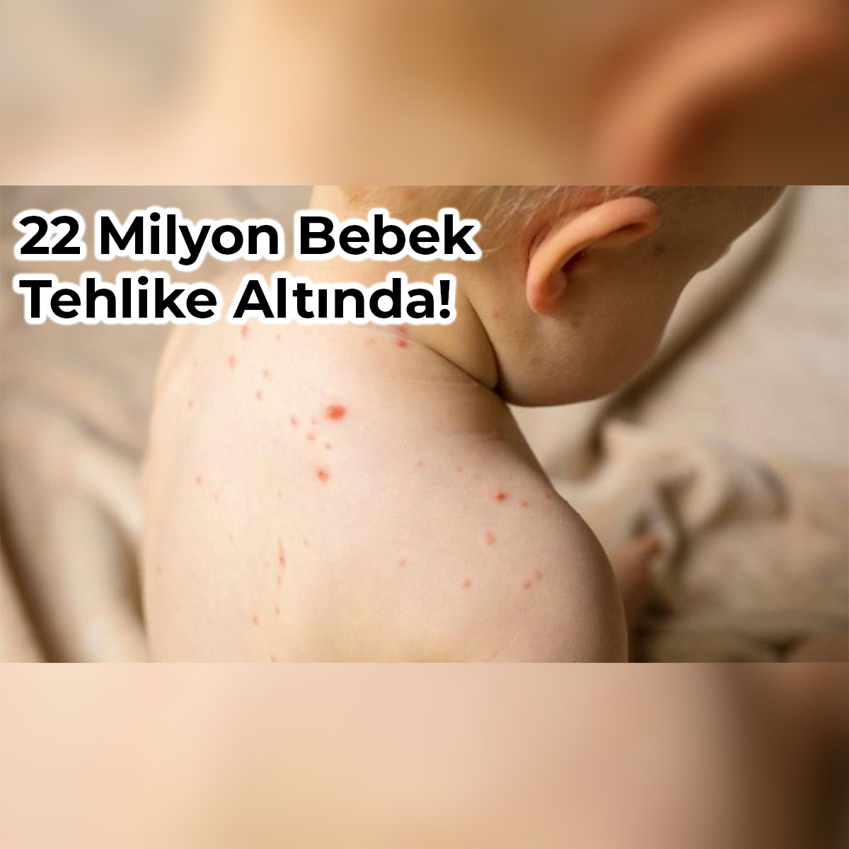 Dsö’den Uyarı: "pandemi Kızamıkla Mücadeleyi Zayıflatıyor"