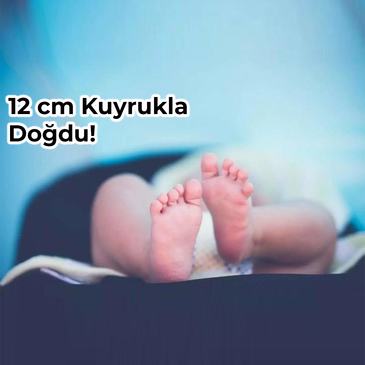 Brezilya’da 12 Cm Kuyrukla Doğan Bebek Bilim Dünyasını Şaşırttı