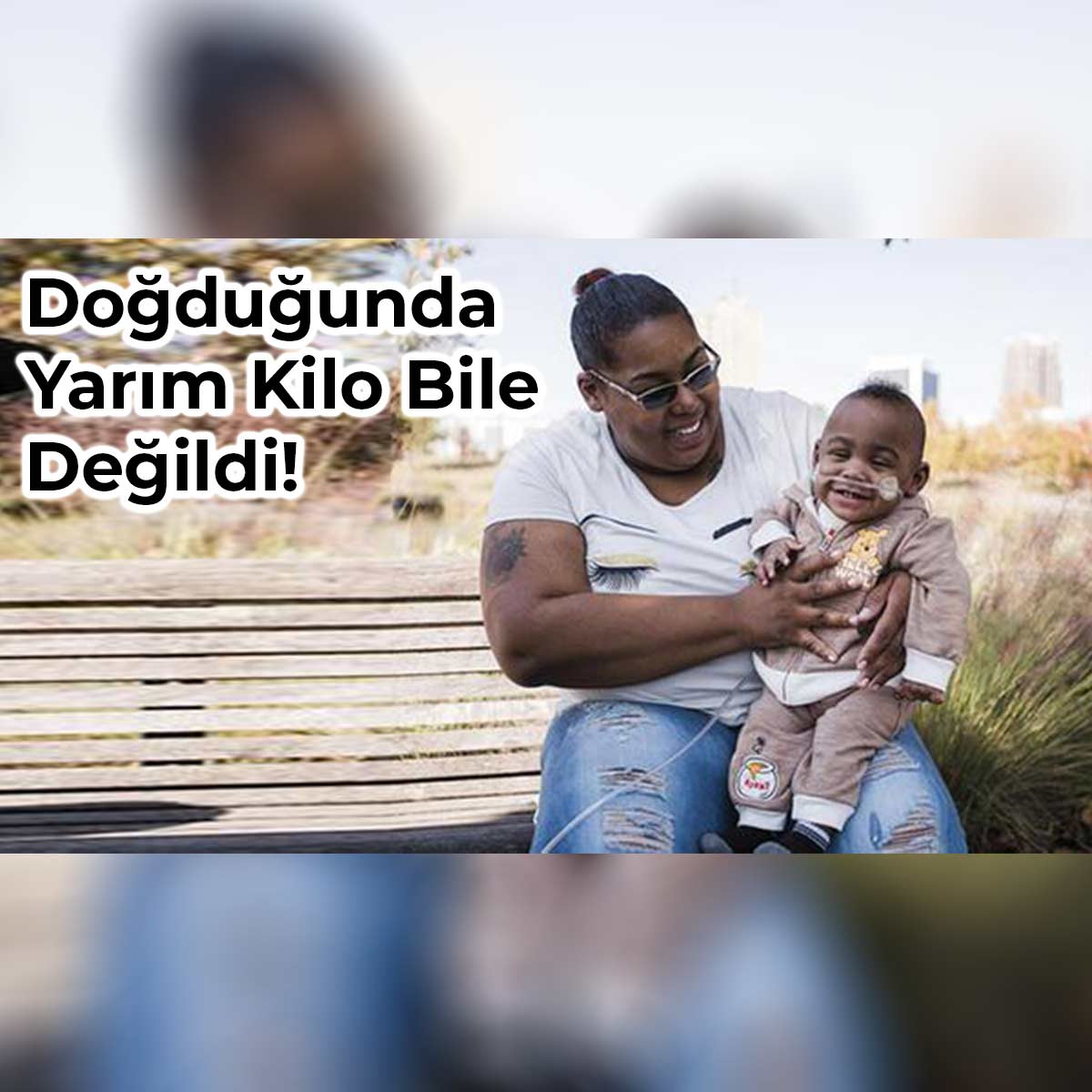 Prematüre Doğan Curtis Bebek Guinness Rekorlar Kitabında!