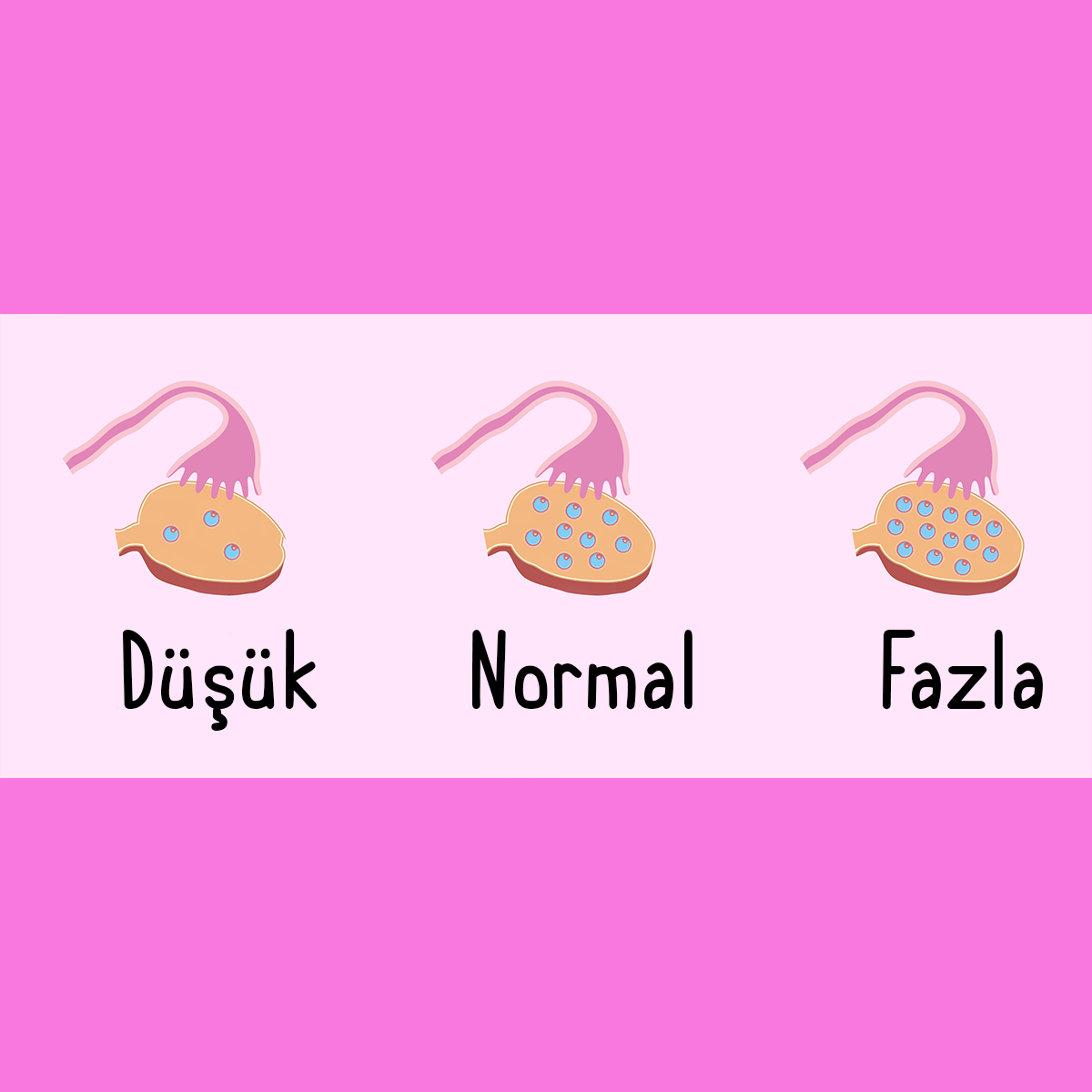Yumurta Rezervi Düşüklüğü Nedir? Belirtileri, Tedavisi Ve Gebeliğe Etkisi