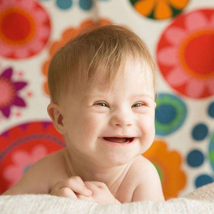 Down Sendromu Nedir?