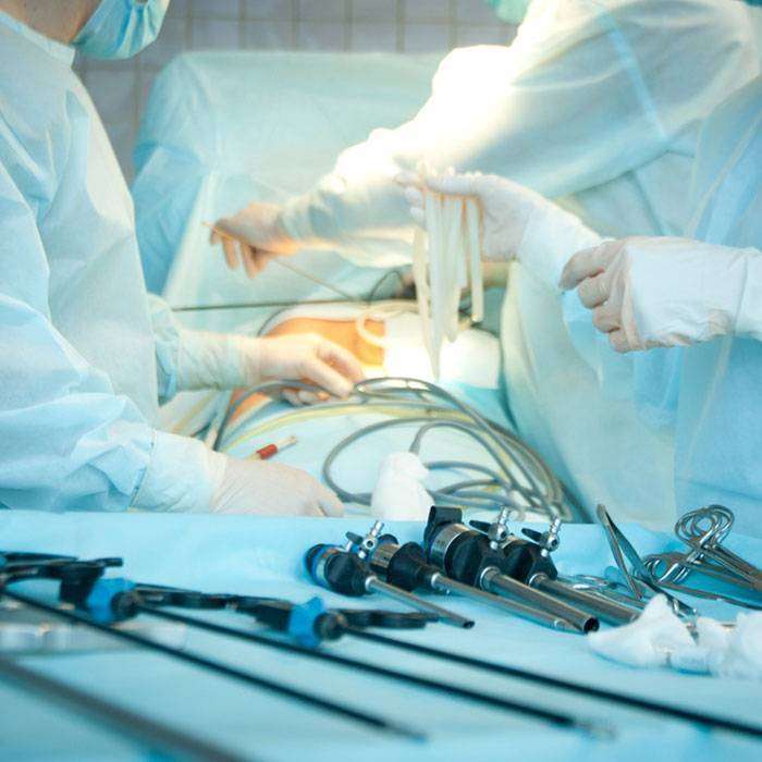 GLaparoskopi Nedir?