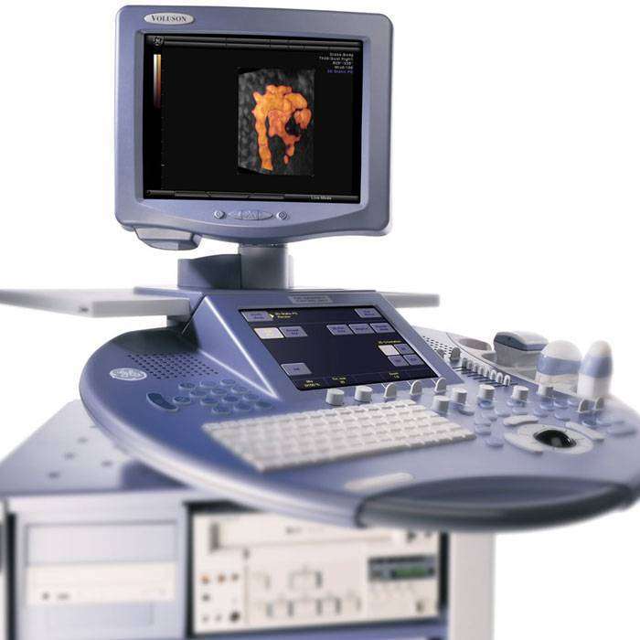 GDoppler Ultrason Nedir?