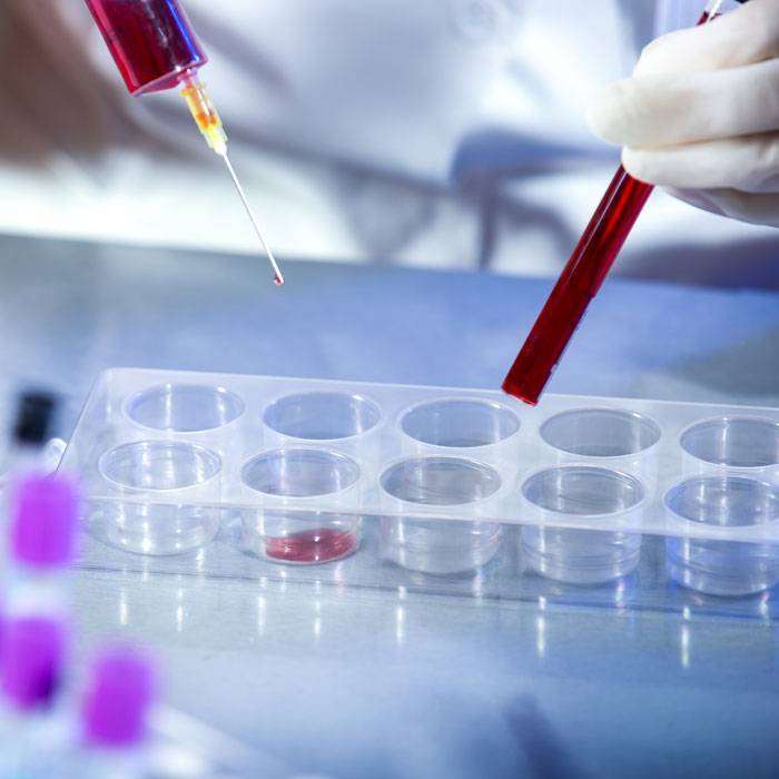 GHıv/aıds Testi Nedir?