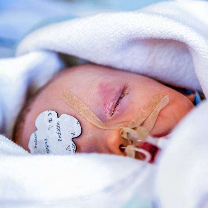 GHiyalin Zarı Hastalığı Nedir?