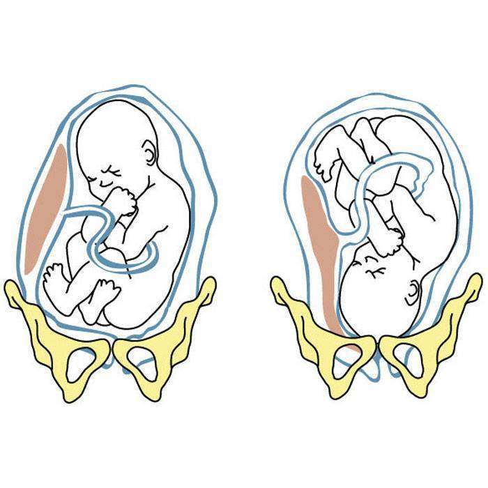 GMakat Prezentasyonu Nedir?