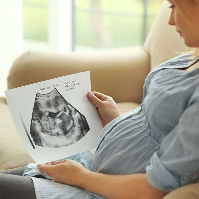 GPrezentasyon Nedir?