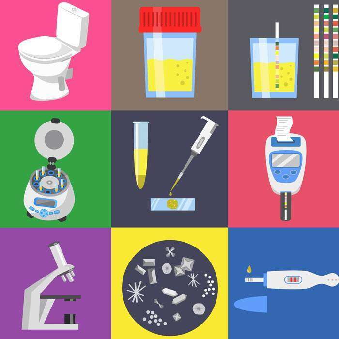 GÜrinanaliz Ve İdrar Kültürü Nedir?