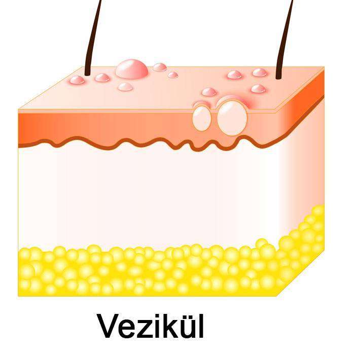 GVezikül Nedir?