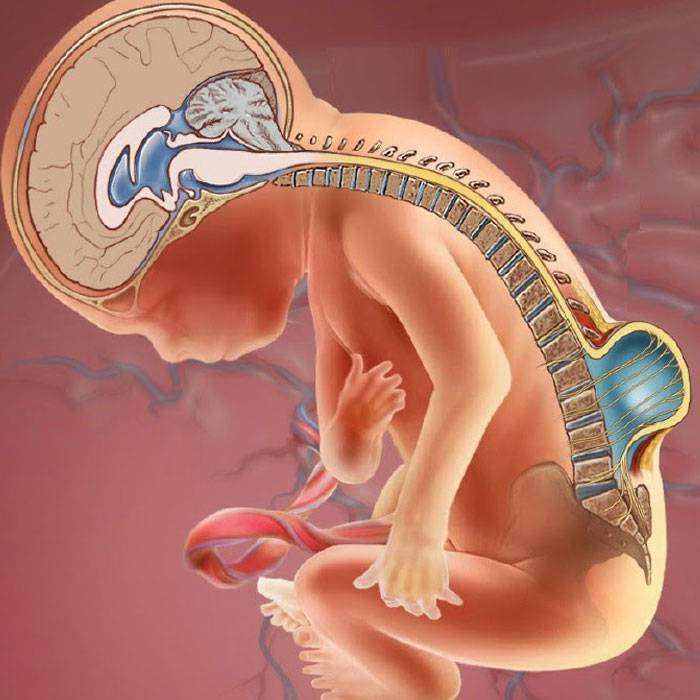 GMeningomiyelosel Nedir?