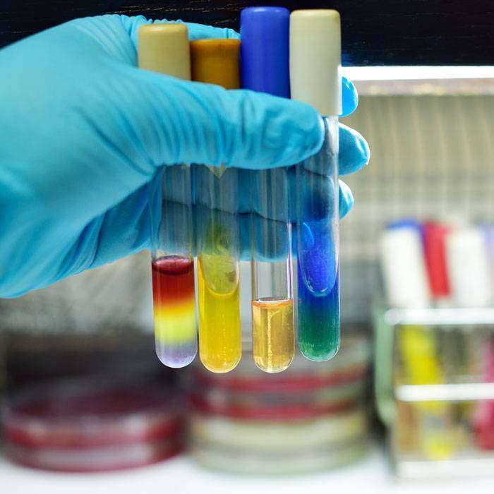 GGrup B Streptokok (gbs) Testi Nedir?