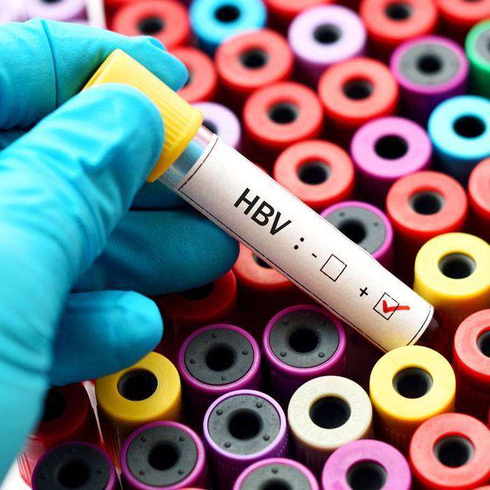Hepatit-b Antikor Testi Nedir?