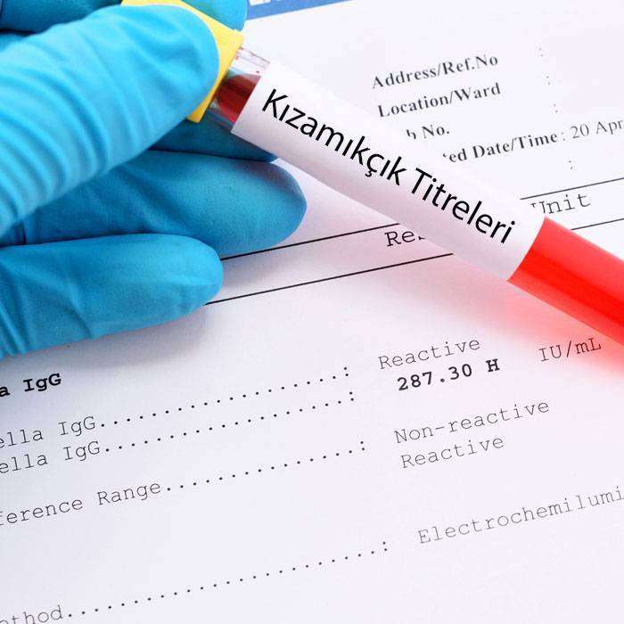 GKızamıkçık Titreleri Nedir?