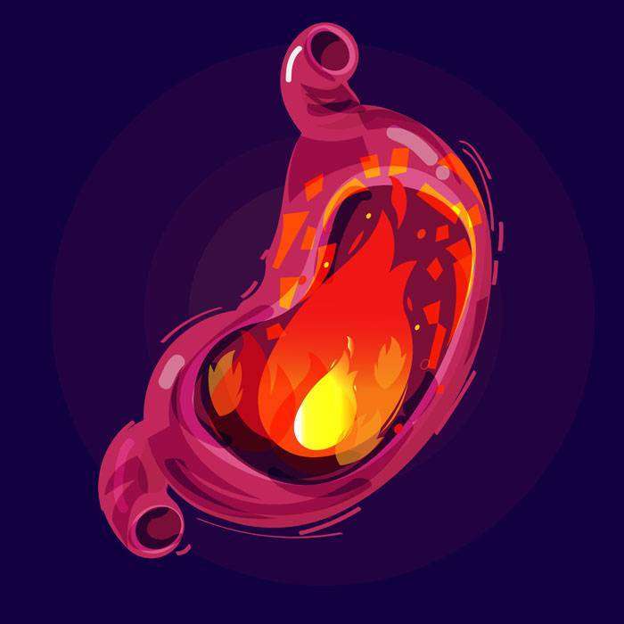 GMide Yanması Nedir?