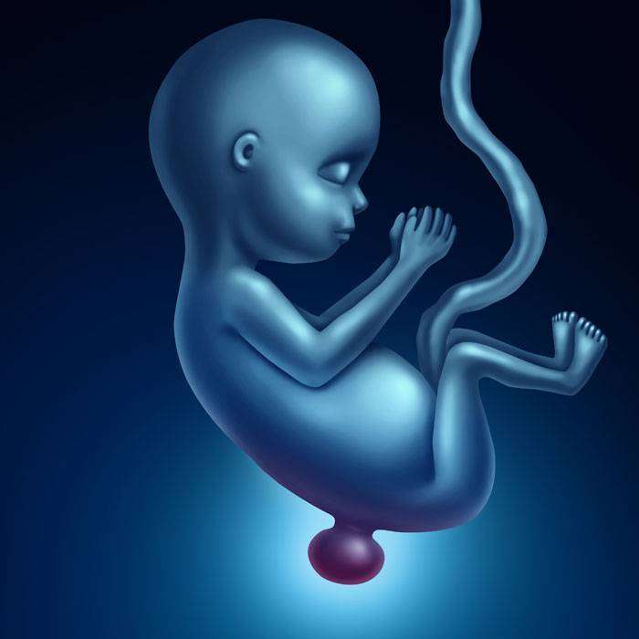 Spina Bifida Nedir?