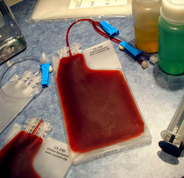 bebeğin kordon kanı