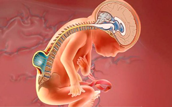 spina bifida nedir