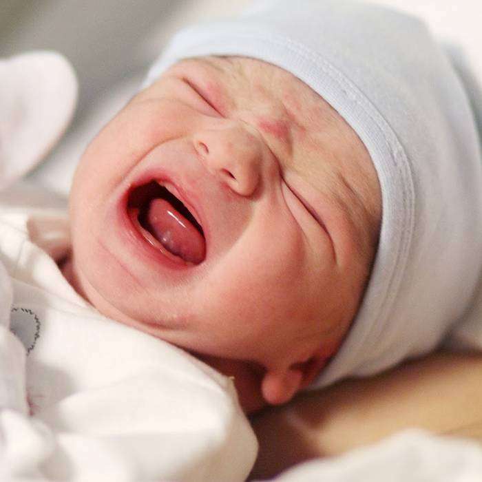 Bebeklerde Kolik Sorununa Akupunktur Tedavisi