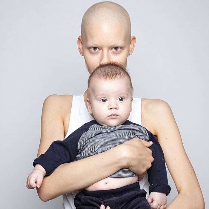 Hamileyken Kanser Olduğunu Öğrenen Mankenin Öyküsü