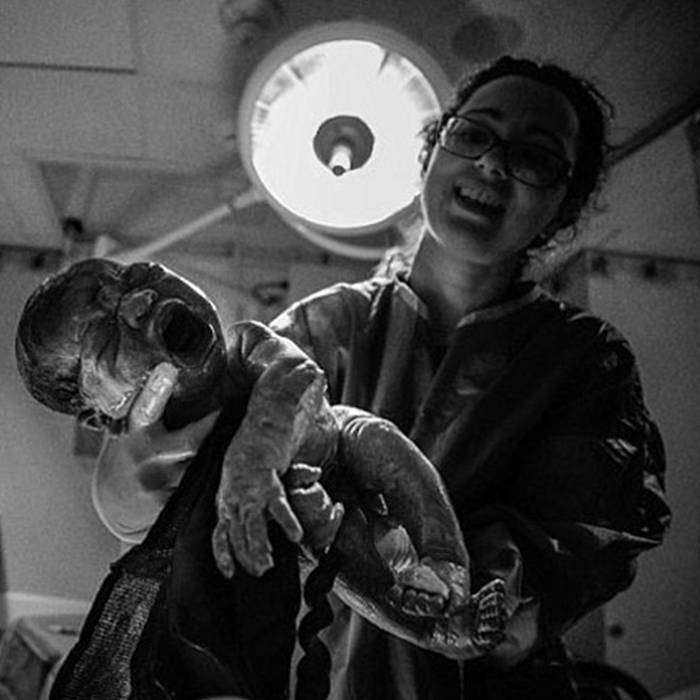 24 Yaşındaki Kadın Doğum Fotoğraflarını Kendisi Çekti