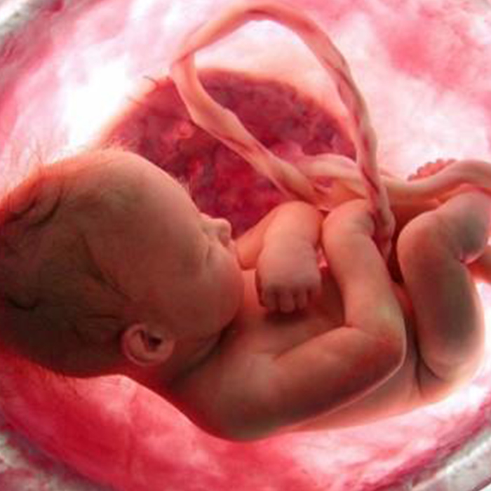 Göbek Kordonu Hemen Kesilmeli Midir?