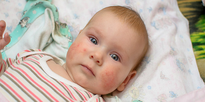 bebeklerde ateşli havale