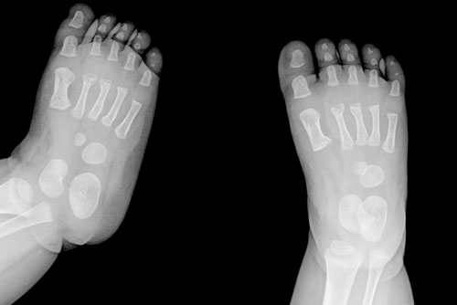 bebegin-iskelet-yapisi