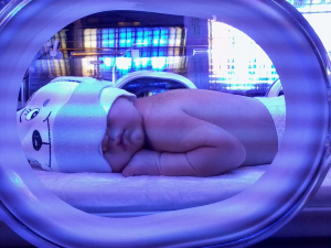 biluribin fazlalığı