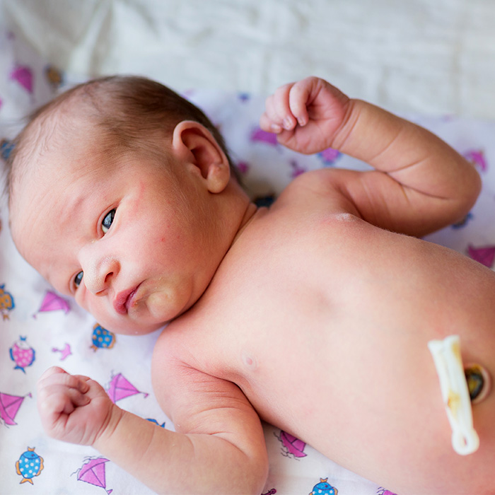 Bebeğinizin Göbek Bağı Bakımını Aksatmayın