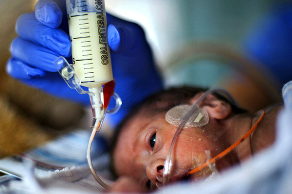 premature-bebeklerde-beslenme-1