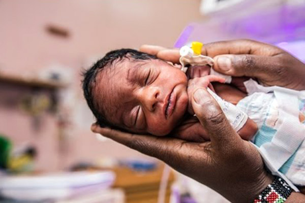 prematüre bebeklerde beslenme