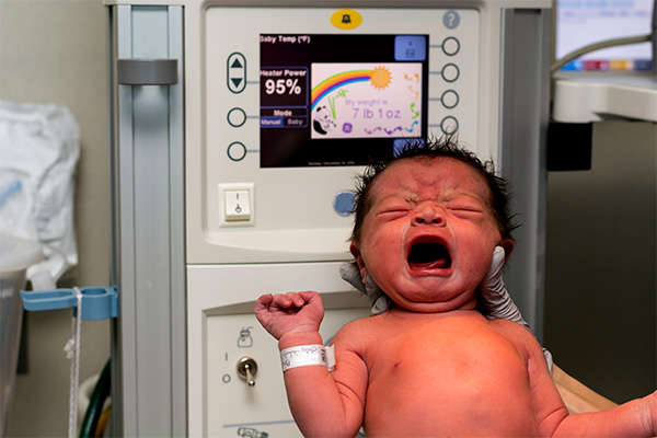 yenidoğan bebeklerde göğüs derisi