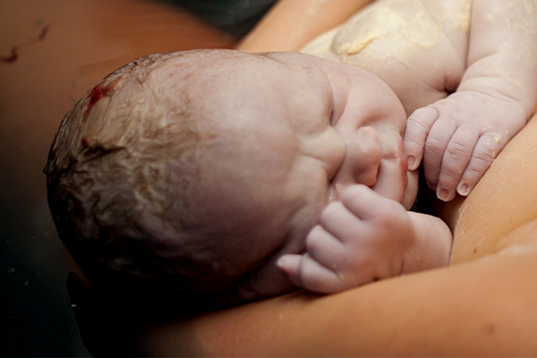 yenidoğan-bebeklerde-kafa