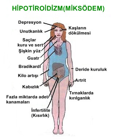 Hipotiroidizm-beliritileri