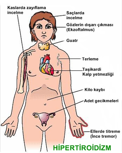 Hypetiroidizm-belirtileri