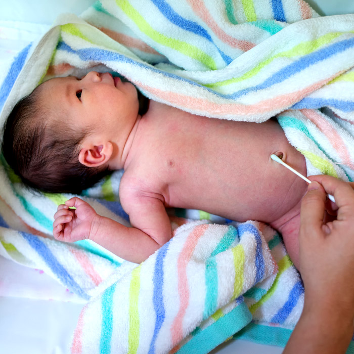 Bebeğinizde Göbek Fıtığı Varsa Neler Yapmalısınız?