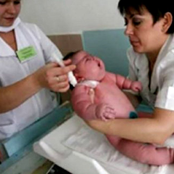 Dünyanın En Kilolu Bebeği Doktorları bile Şaşkına Çevirdi!