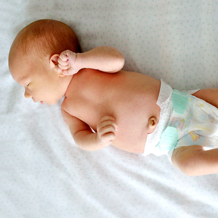 GGöbek Fıtığı Nedir?