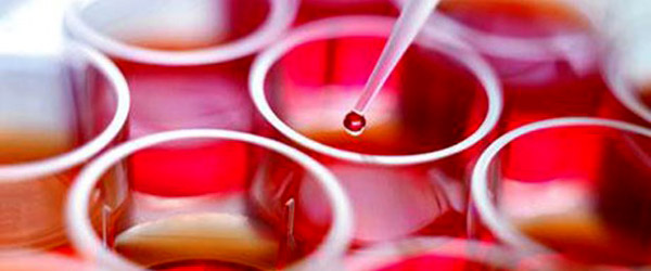 kök-hücre-terapisi 