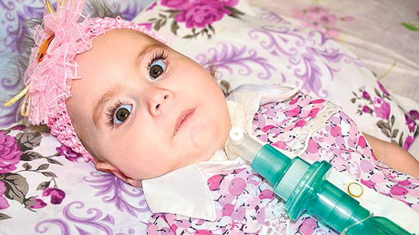 SMA Hastası Zeynep Fatma