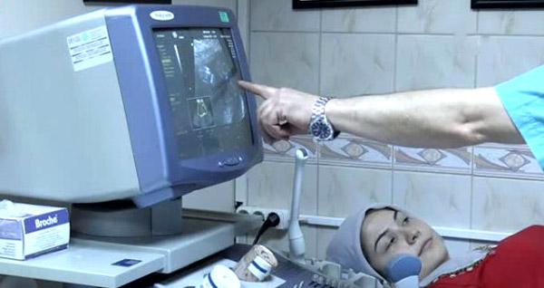 ayağı gelişmeyen bebeğe ameliyat