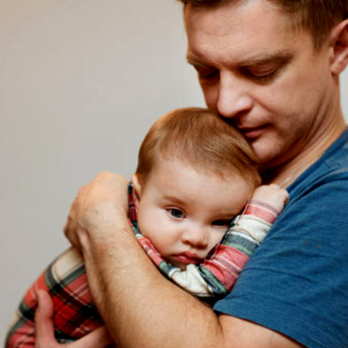 Hipotonik (gevşek) Bebek Sendromu Nasıl Anlaşılır?