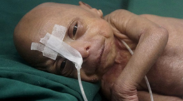 Bangladeş'te Yaşlı Bebek