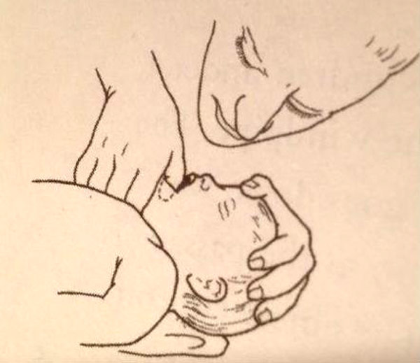 bebeklerde yabancı cisim yutma 